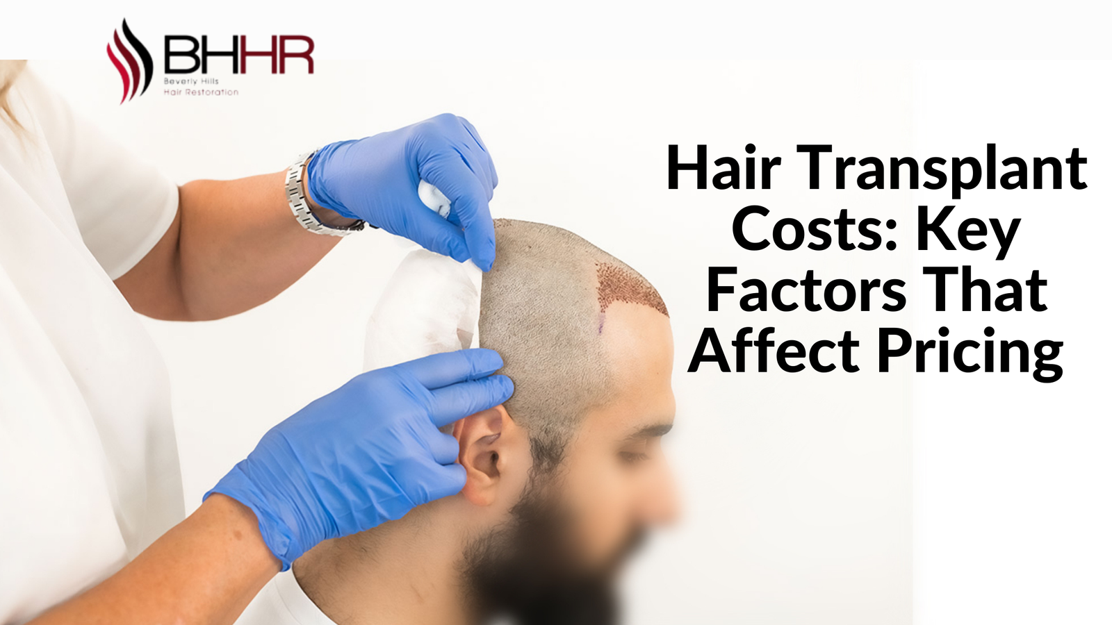 hair transplant price