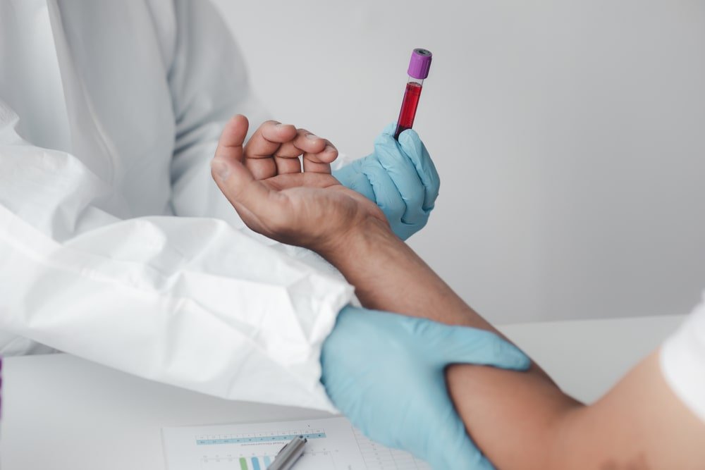 Stay Healthy: How to Get the Best Blood Tests in Stafford